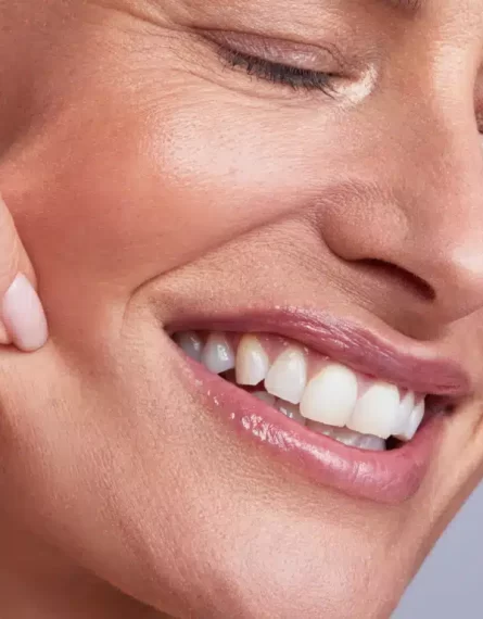 collagen_stimulator_aesthetics